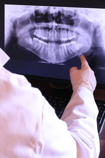 Best Root Canal Emergency Dentist  in Albany, LA